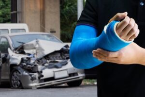 Average Settlement For Broken Arm in Car Accident