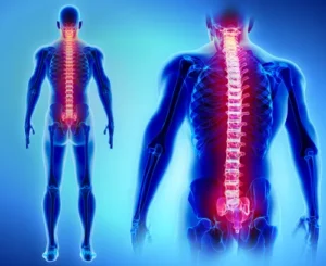 A diagram illustrating the spinal cord, nerve roots, and motor vehicle accidents, showing how a complete spinal cord injury impacts multiple body functions.